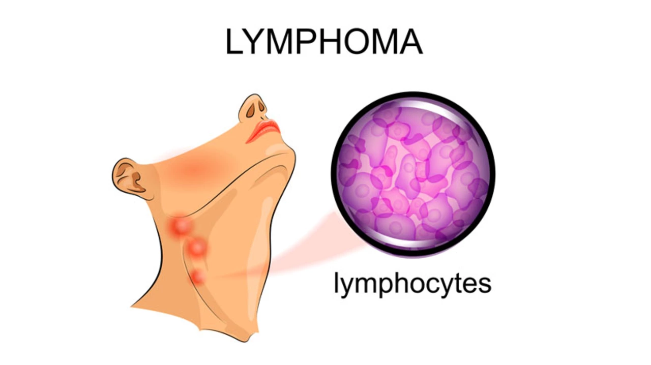Cell Lymphoma: A Closer Look at the Different Stages