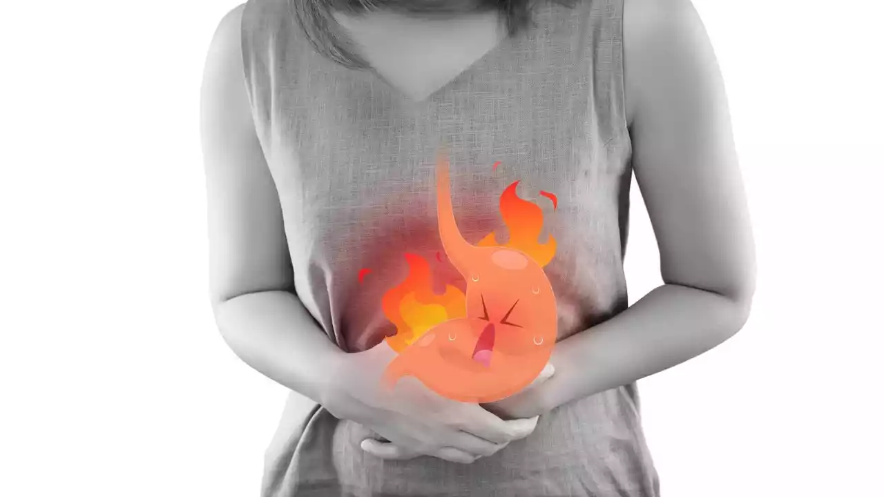 The link between acid reflux and coughing